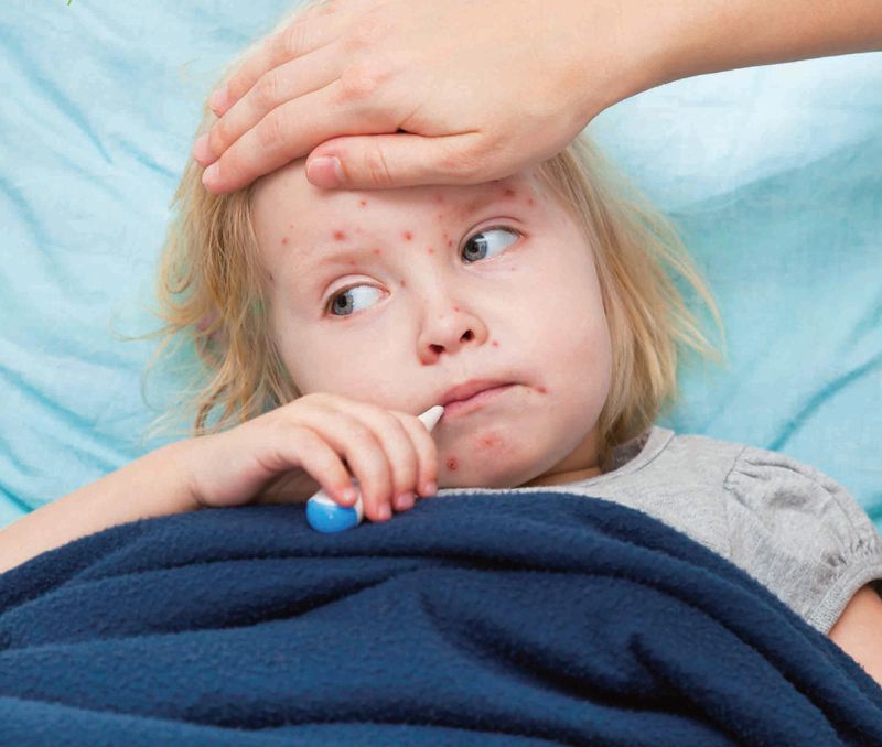 Санэпидслужба предупреждает о вспышке кори в Украине и ряде стран Европы