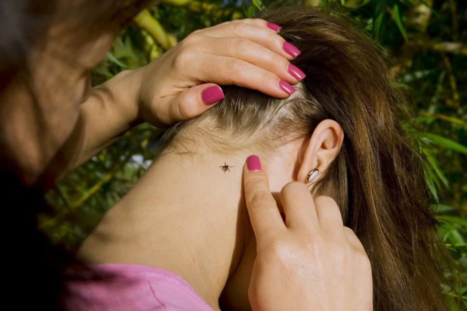 «Прямая линия» по вопросам оказания медпомощи при укусе клеща пройдет в Могилеве 12 июня