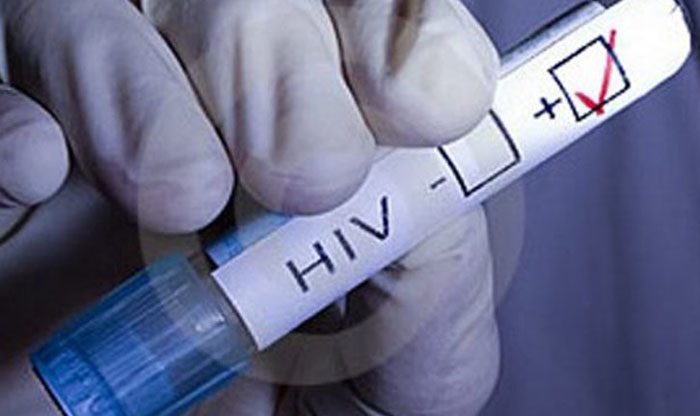 28 случаев постановки на учет людей с ВИЧ-инфекцией выявлено в Могилеве