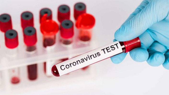 Тестируем «корону» дома (лайфхак)