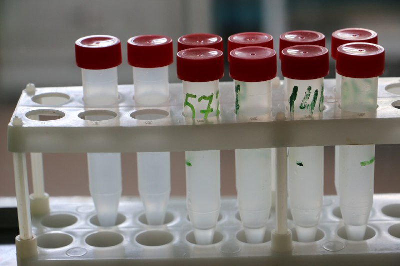 Коронавирус в Беларуси. Ситуация на 2 ноября. Официальная статистика