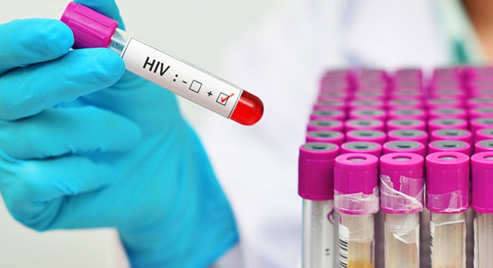 Большинство случаев ВИЧ-инфекции зарегистрировано в возрастной группе 30-39 лет в 2019 году в Могилевской области