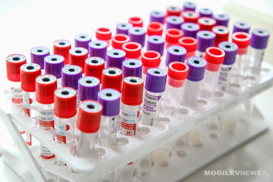 Коронавирус в Беларуси. Ситуация на 2 октября. Официальная статистика