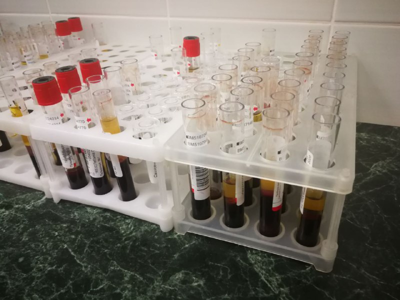 Коронавирус в Беларуси. Ситуация на 21 ноября. Официальная статистика