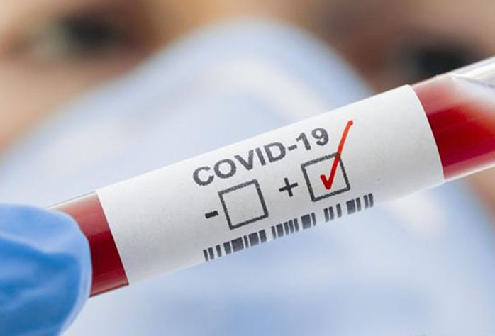 Коронавирус в Беларуси. Ситуация на 14 сентября. Официальная статистика