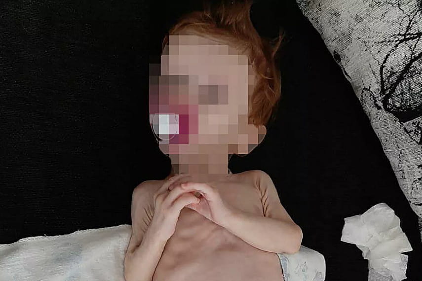 Девочку, которую полгода держали в шкафу на Урале, выписали из больницы