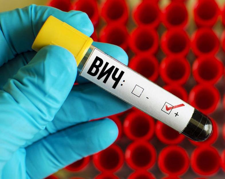 Ситуация с ВИЧ-инфекцией в Могилеве и Могилевском районе