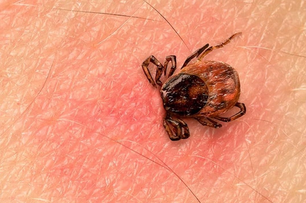 60 случаев Лайм-боррелиоза зарегистрировано в Могилевской области за 7 месяцев