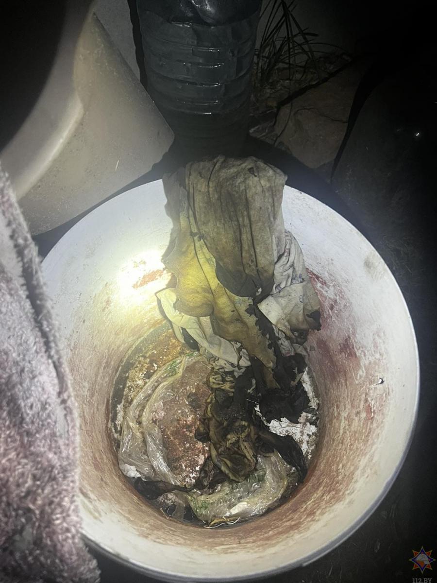 В Бобруйске 58-летняя женщина получила ожоги. Врачи оказались бессильны