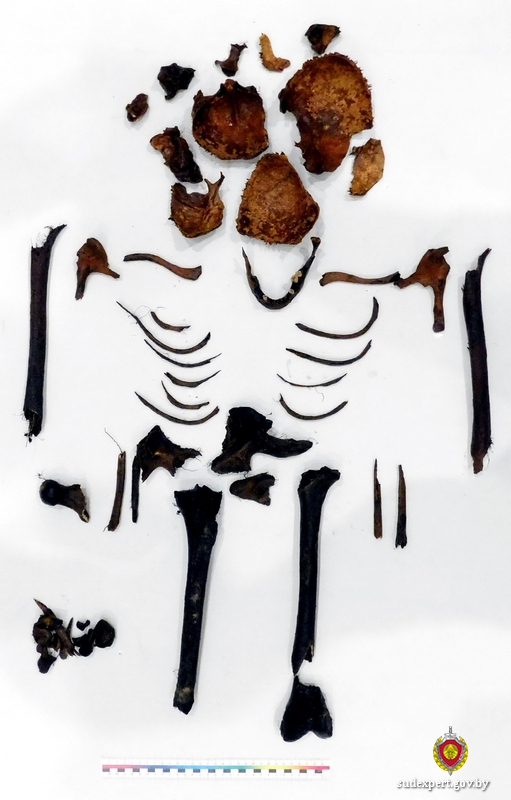 Человеческие останки более 90 жертв геноцида времен ВОВ, обнаруженные в Славгороде, исследовали судебные эксперты