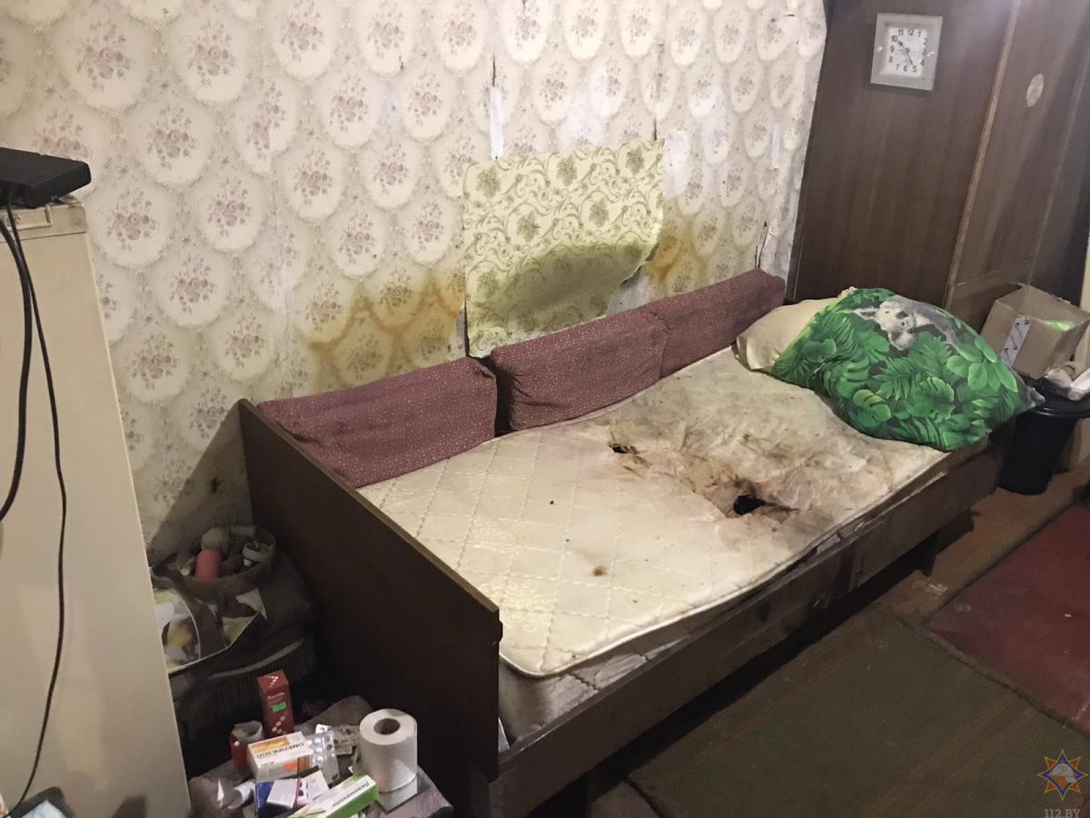 Уснул с сигаретой в постели: в Костюковичах пенсионер получил ожоги