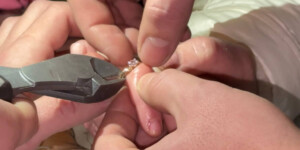 В Дрибинском районе спасатели помогли девочке снять застрявшее кольцо