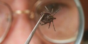 Порядка 4 тысяч человек обратились за медпомощью в Могилевской области по поводу укусов клещей за 10 месяцев