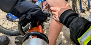 В Климовичах мальчик застрял ногой в велосипеде: помогло МЧС