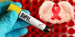 О выявленных случаях ВИЧ-инфекции в Могилевской области рассказали эпидемиологи