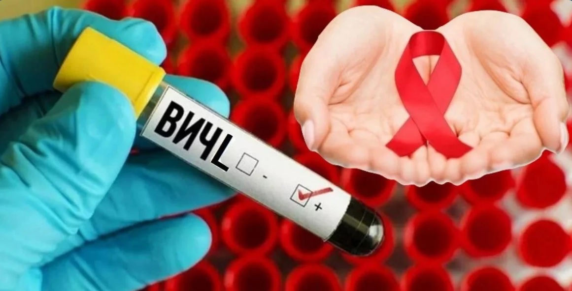 О выявленных случаях ВИЧ-инфекции в Могилевской области рассказали эпидемиологи